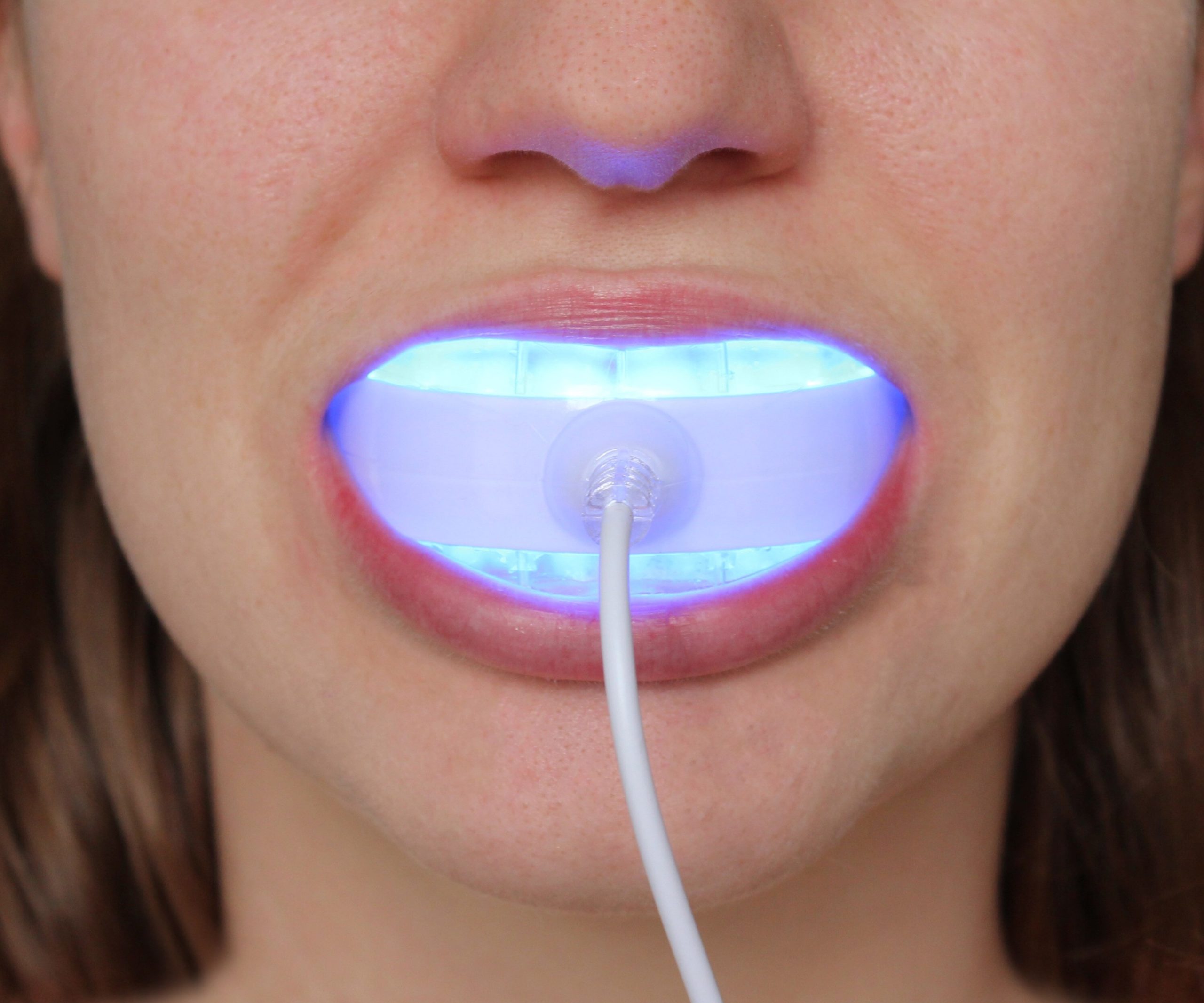 Is blue light ok for teeth?